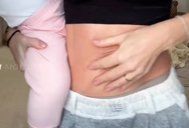 Анна Хилькевич показала дряблый живот